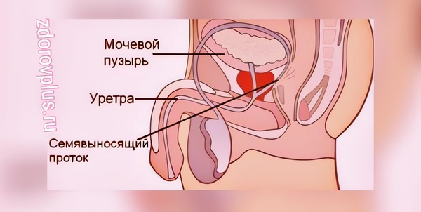 Инфекция моче-половой системы у мужчин